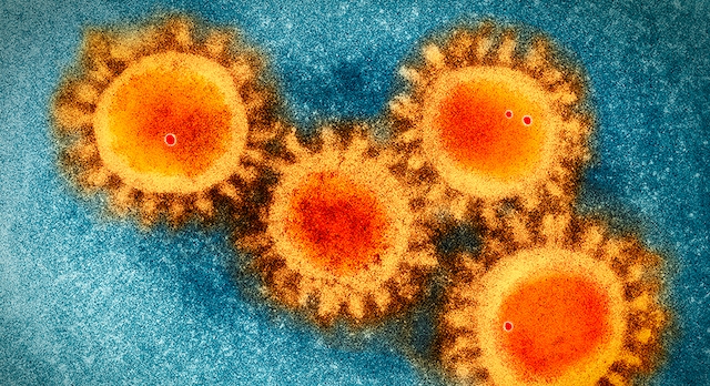 Is COVID-19 coronavirus a bioweapon or did it evolve naturally